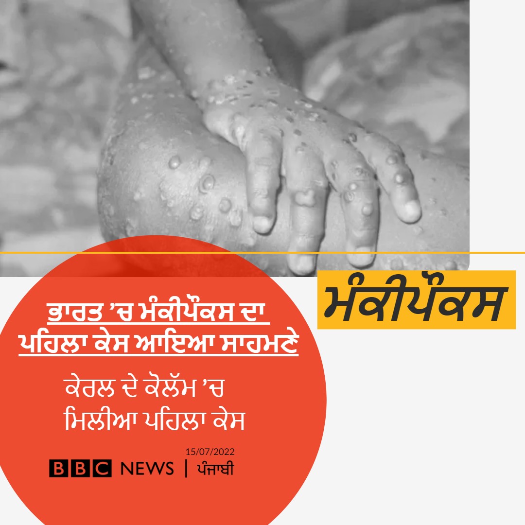 bbcnewspunjabi's tweet image. 50 ਤੋਂ ਜ਼ਿਆਦਾ ਦੇਸ਼ਾਂ ’ਚ ਫੈਲ ਚੁੱਕੇ ਮੰਕੀਪੌਕਸ ਨੇ ਹੁਣ ਭਾਰਤ ’ਚ ਵੀ ਦਸਤਕ ਦੇ ਦਿੱਤੀ ਹੈ। ਕੇਰਲ ’ਚ ਪਹਿਲਾ ਕੇਸ ਸਾਹਮਣੇ ਆਇਆ ਹੈ। 
ਕਿੰਨਾ ਖ਼ਤਰਨਾਕ ਹੈ ਮੰਕੀਪੌਕਸ -  bbc.in/3z7OvhJ
#Monkeypox #FirstCase #India