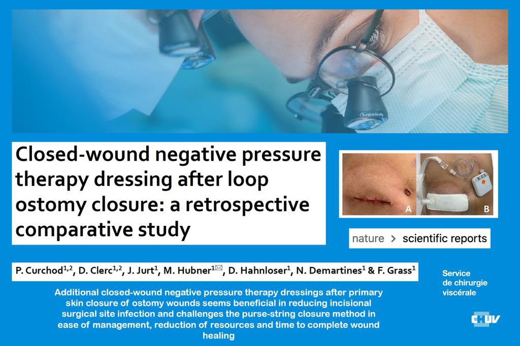 Congratulations to Pauline Curchod for her thesis studying the reduction of incisional surgical site infections with the introduction of closed-wound negative pressure wound therapy dressings in ostomies. Read it here 👉 Go.nature.com/3IDWBSq #CHVresearch #chvteachinghospital