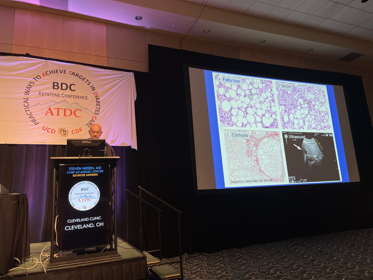 ATDCcon's tweet photo. We are underway for day two of #ATDC2022! So far, we had an impactful presentation by Dr. Steven Nissen as well as a riveting panel discussion on Diabetes Outcomes. Up next, Healthcare Costs &amp; Outcomes! https://t.co/UBvvPIlTOX