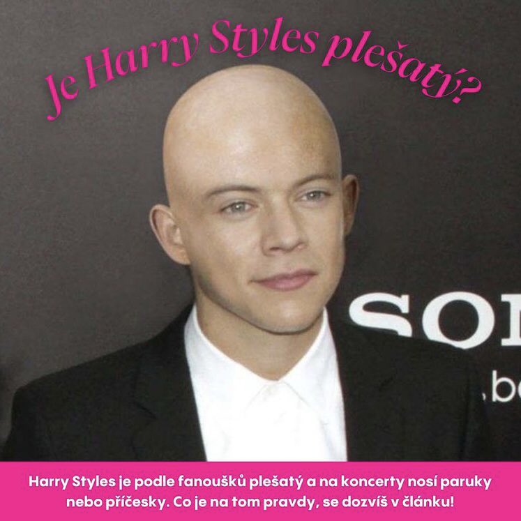 heyfomocz's tweet photo. Je Harry plešatý? Možná se víc dozvíme dnes na koncertě 😱 https://t.co/TtKgGRQkww