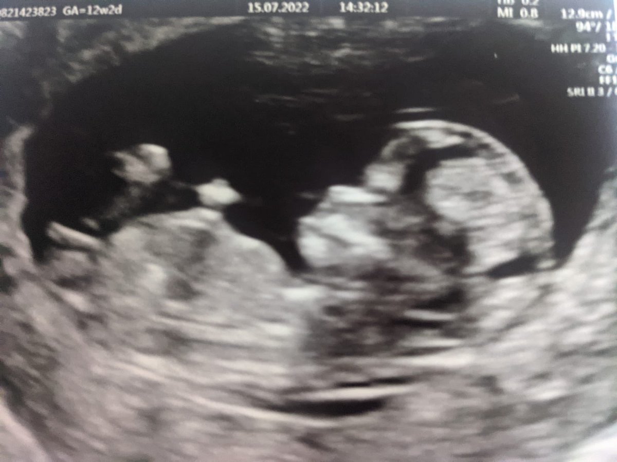 I havnt tweeted for some time but just thought I’d announce .. we are expecting :)
