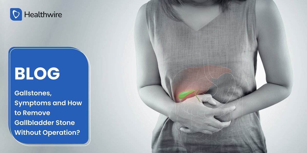 healthwirepk's tweet photo. 𝐆𝐞𝐭 𝐑𝐢𝐝 𝐨𝐟 𝐆𝐚𝐥𝐥𝐛𝐥𝐚𝐝𝐝𝐞𝐫 𝐒𝐭𝐨𝐧𝐞𝐬 𝐖𝐢𝐭𝐡𝐨𝐮𝐭 𝐒𝐮𝐫𝐠𝐞𝐫𝐲!
 
Read this article to know how you can prevent gallstones formation with some simple lifestyle habits.

https://t.co/j9JPLIqoLf
.
.
.
#gallstones #gallbladder #gallbladdersurgery #gallstone https://t.co/2WDfzXN5gz