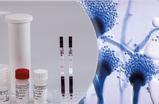 alphalabs's tweet image. We&apos;ll be at @Micro_BSMT&apos;s Annual Conference in London next week, will we see you there? Caroline and Maria will be available to discuss our range of products including the sōna #Aspergillus Galactomannan and #Cryptococcal Antigens (CrAg) Lateral Flow Assays from @IMMYdiagnostics