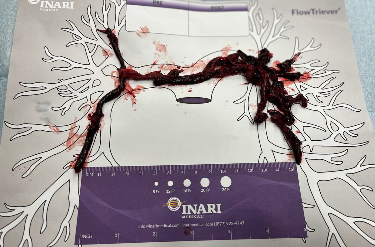 Ranjan Dahal tweet media