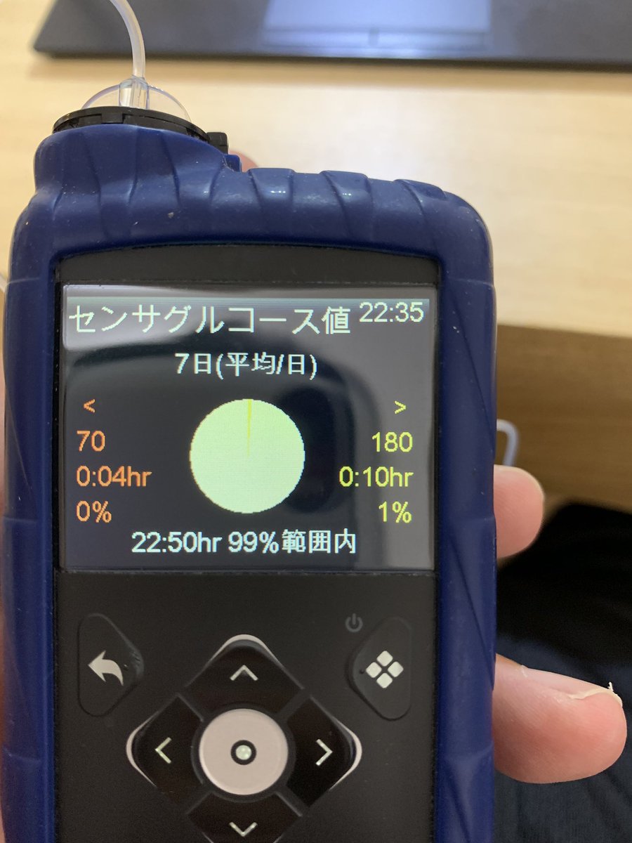 toshi_idmm's tweet photo. 770Gを乗りこなせるようになってきたかも。QOL向上している。
#770G https://t.co/NW0M7jbY9e
