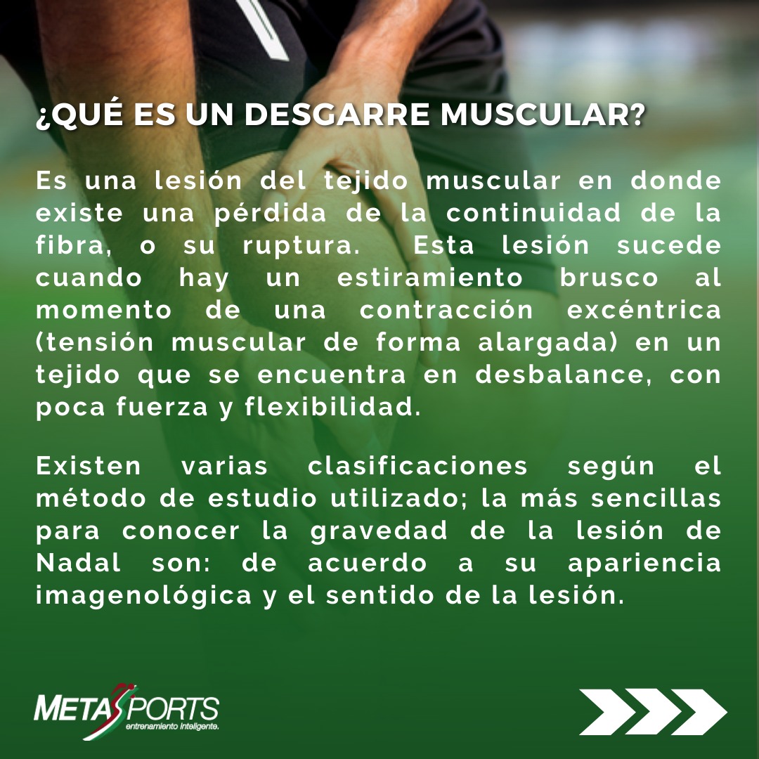 MetasSports's tweet image. ¿Qué es un desgarre muscular?
Una lesión del tejido muscular con pérdida de la continuidad de la fibra, o su ruptura. Ocurre cuando hay un estiramiento brusco al momento de una contracción excéntrica  en un tejido que se encuentra en desbalance ( poca fuerza y  flexibilidad)