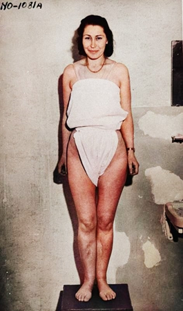 ReidEdwardII's tweet photo. War crimes investigation photo of Władysława Karolewska, a Polish survivor from Ravensbrueck subjected to medical experiments with sulphonamide drugs in 1942.

Purposely infected with bacteria, dirt &amp; slivers of glass, simulating the combat wounds of soldiers fighting in the war. https://t.co/1IJeoXLwRY