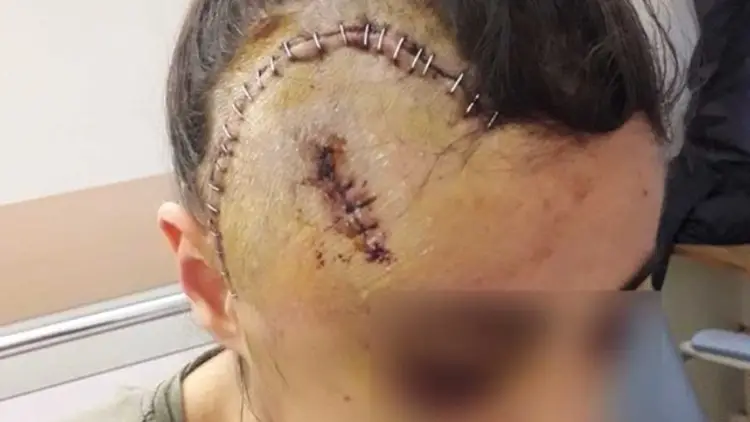 MRGNDRFFR's tweet photo. @prefpolice Si vous mettez le même zèle que quand il s'agissait de retrouver les flics qui avait ouvert le crane de Maria en 2018...

https://t.co/AMhTIl0oYJ https://t.co/Ba58IkI4Yo