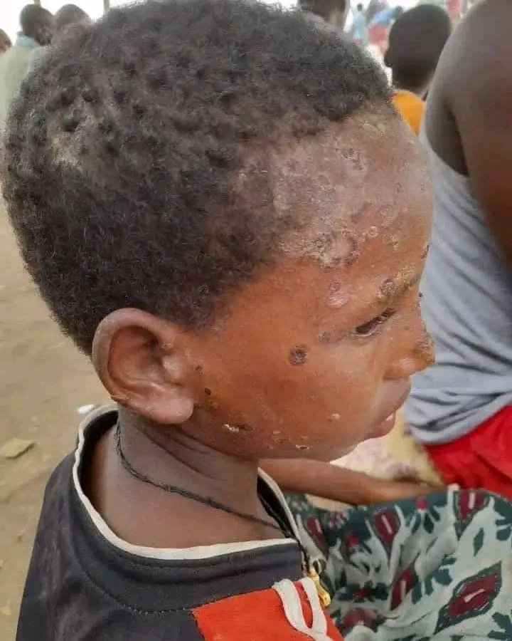 Wedi_AbayT's tweet photo. Bleeding inside💔

#Tigray:children r extremely under #siege n #suffering due2 lack of #Medicine n #food.IC pls don't left them 2 #die

We r part of z 🌍 n we highly demand ur #help,#support n #justice

#PutHumanityFirst
#EndTigraySiege
@hrw @WFP @WHO @IntlCrimCourt https://t.co/qKIDNvyYOd