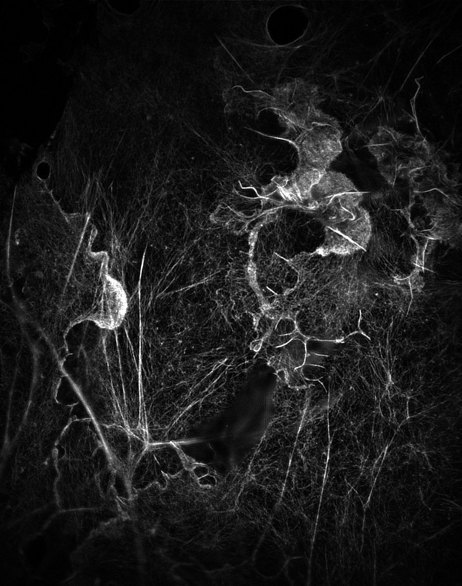 TMangeat's tweet photo. Happy #FluorescenceFriday. RIM TIRF images. Sample made from #chrislet lab! https://t.co/TQcQa6zIA3