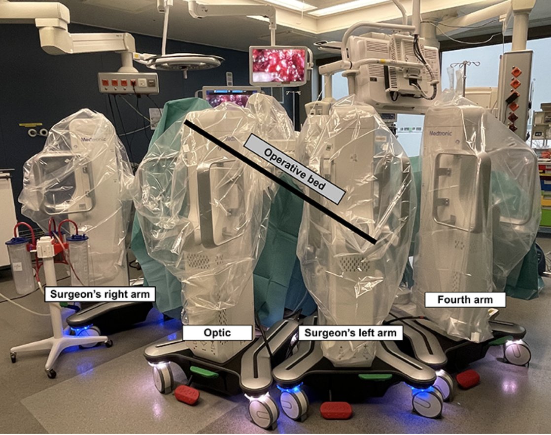 urotoday's tweet photo. Entering a new era of robotic surgery: robot-assisted radical prostatectomy with the novel “HUGO” robotic system. #BeyondTheAbstract > https://t.co/NVBNRwMGOl @ca_bravi @Marco_Paciotti_ @luca_sarchi @AngeloMottaran @pidebacker @VinckierMH @gdnaeyer @Ruben_De_Groote @alexmottrie https://t.co/oqFBood007