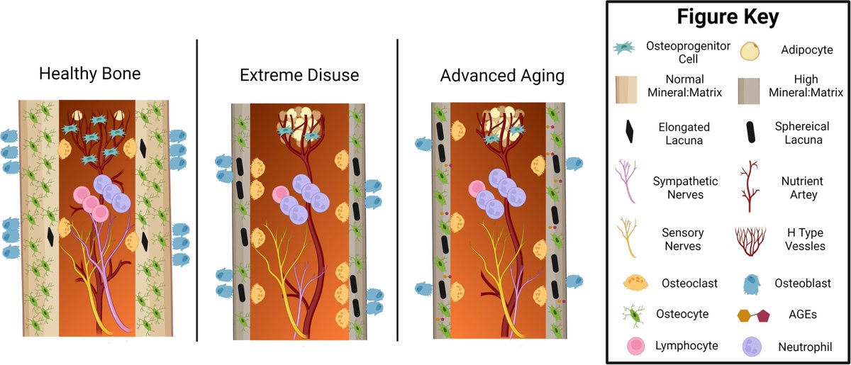 BESTLabVCU's tweet photo. Really excited to share our recent JBMR Review article by @EvanBuettmann and colleagues @tamuvetmed @VCU_BME detailing similarities in bone loss with skeletal disuse and aging and potential avenues for future research  @ASBMR @ORSsociety #orthoresearch https://t.co/8bAB3wv5hk https://t.co/TFSo5fIyx9
