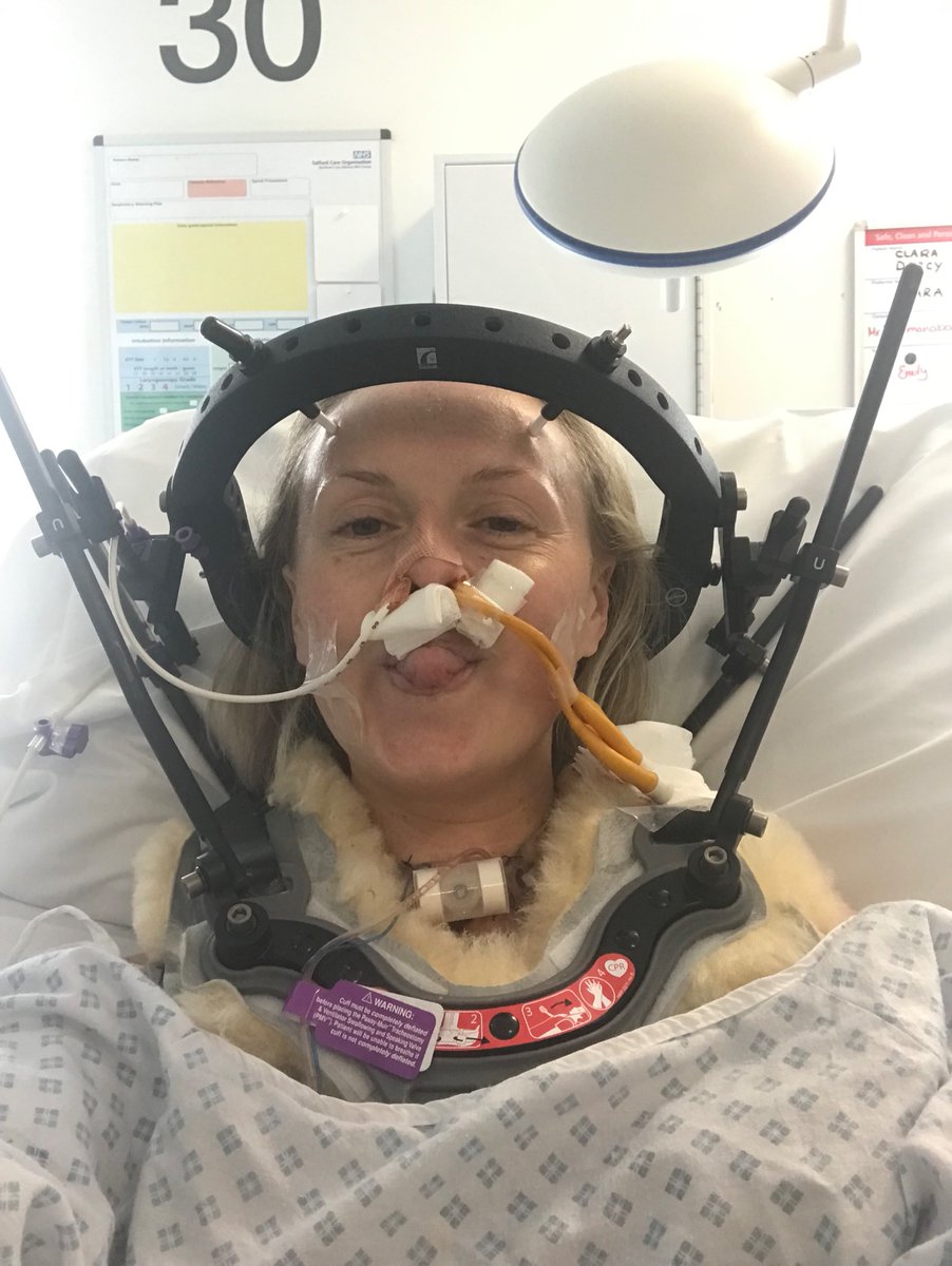 MissCDarcy's tweet photo. 3 years to the day
14 + a half hours of surgery
#braintumour removed through my nose
Still standing thanks to the skill of an incredible few & the love of a thousand more β€οΈ
Hear me share my story @tbtlake later this month & @edfests @AssemblyFest in August
#HaveMoreDancing https://t.co/l0NkhRIZQW