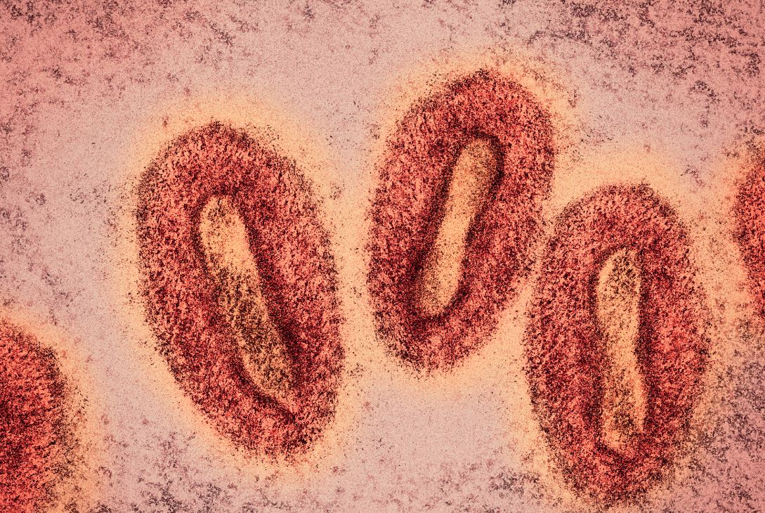 Find the latest demographic and clinical information on monkeypox cases reported in Ontario to date in our updated epidemiological summary: ow.ly/ijEM50JX88g
