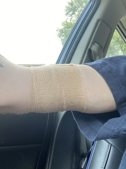 i basically can’t use this arm for 24 hours or else it could cause the implant to migrate or pop out