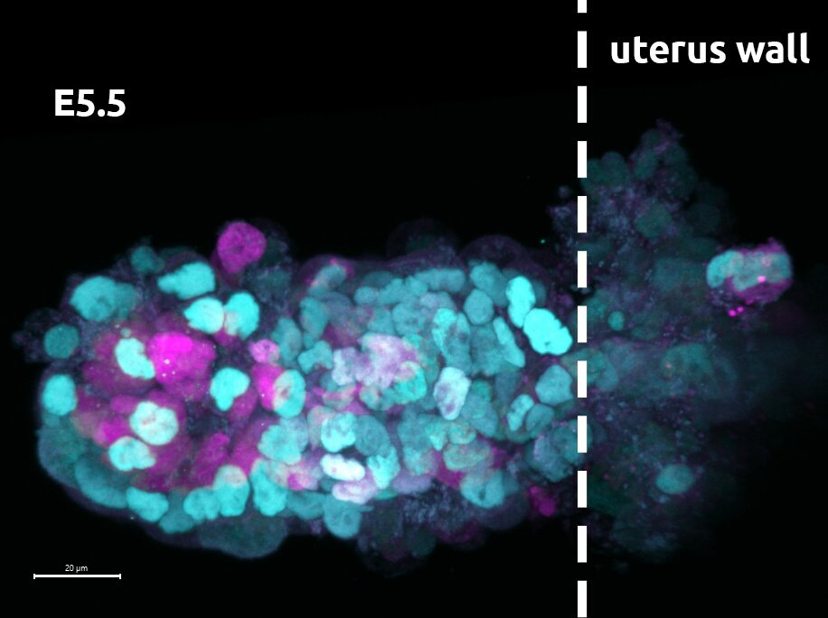 Fluorescent mouse embryos ！cells that will form the embryo proper (magenta) and cells that will form the supportive structures (cyan) at embryonic day (E) 3.5, 4.5 (blastocysts) and during implantation at 5.5. #fluorescentfriday #embryo #confocalmicroscopy