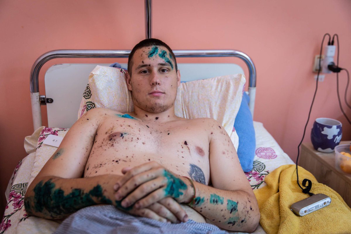 natemook's tweet photo. Diana, Nika, Glyb &amp; Alexei were celebrating graduation when a missile struck their hotel near Odesa. The @WCKitchen team went to visit them in the hospital. I share these photos, as it’s important to see what people are going through in Ukraine. Still, they remain so strong. ❤️‍🩹🇺🇦 https://t.co/nzR6SZFnpt