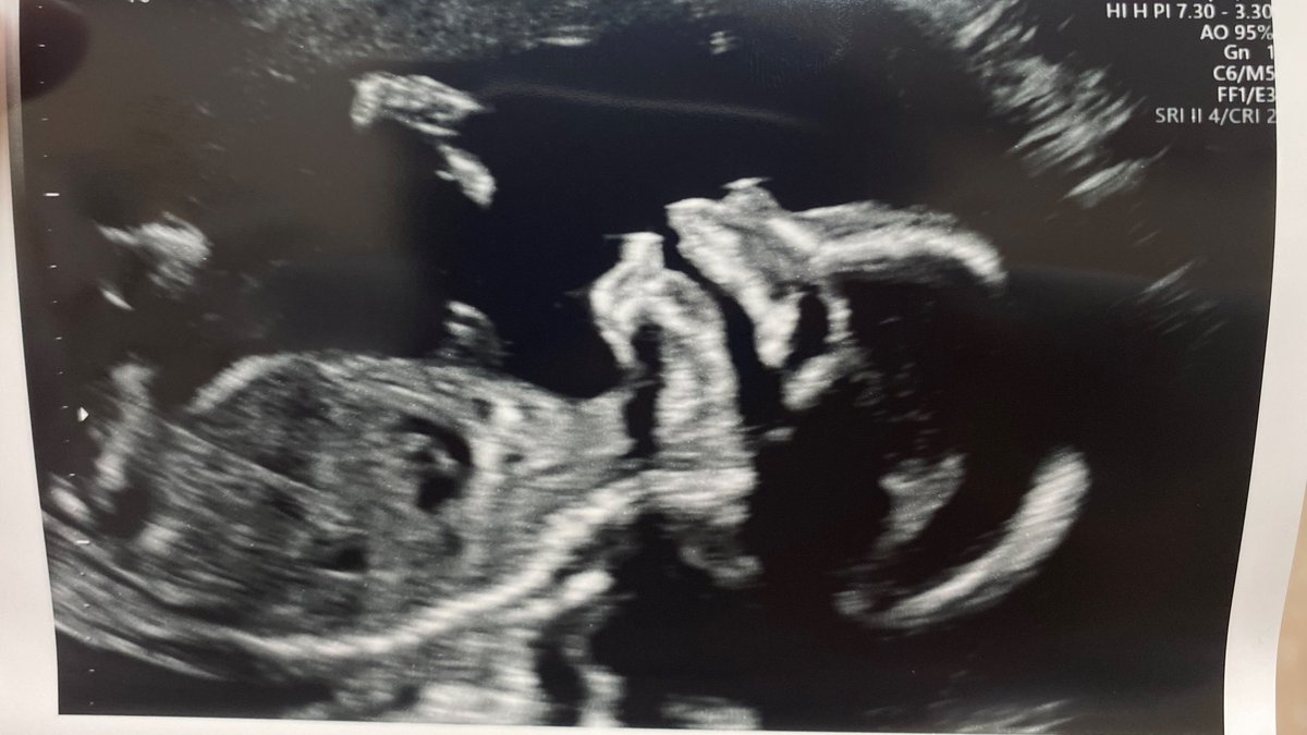 ZWillingham's tweet photo. I’m so ready to meet my little boy. You are loved Noah Zachari Willingham. https://t.co/zpvwFukJ2v