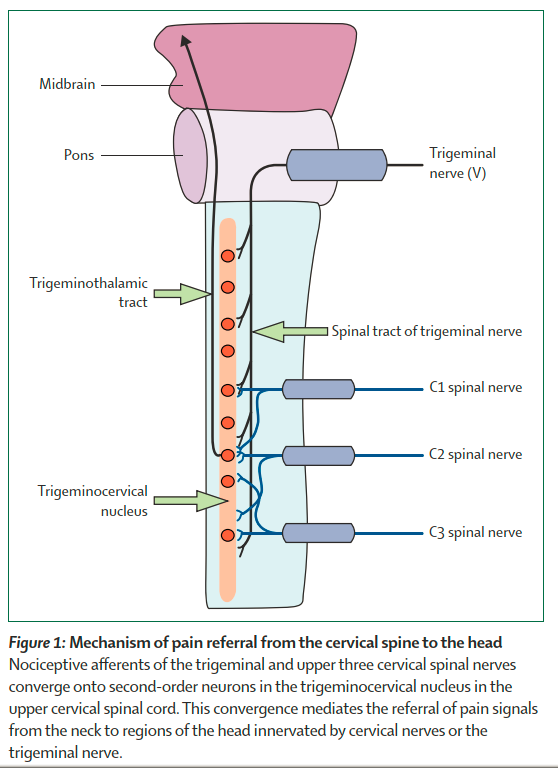 PhysioMeScience's tweet photo. Cervicogenic headache: an assessment of the evidence on clinical diagnosis, invasive tests, and treatment

🤕🤕🤕

https://t.co/vbvzc6TxIS https://t.co/fKYzYB6Mzy