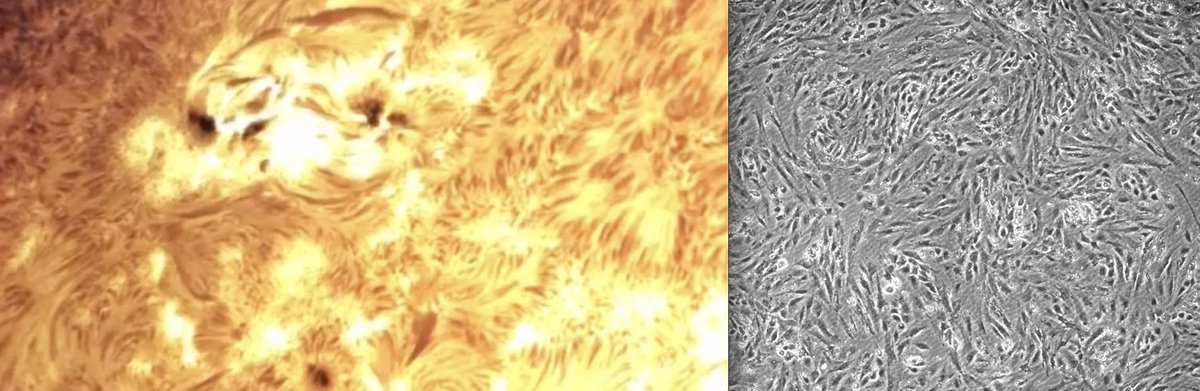 chellebalez's tweet photo. My uncle showed @CloudyKielkopf, @soniusly and I his solar telescope and I gotta say the sun looks a lot like fibroblasts as they reprogramming to iPSCs 🧡☀️🧡 https://t.co/0vrX7xyzKS