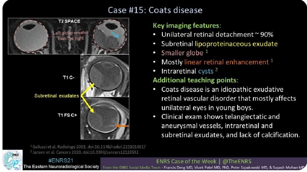 FatemehDst's tweet image. Thank you very much for your instructive post.I came with the wrong answer, so I decided to keep it here to always bear in mind.
#RSNA21