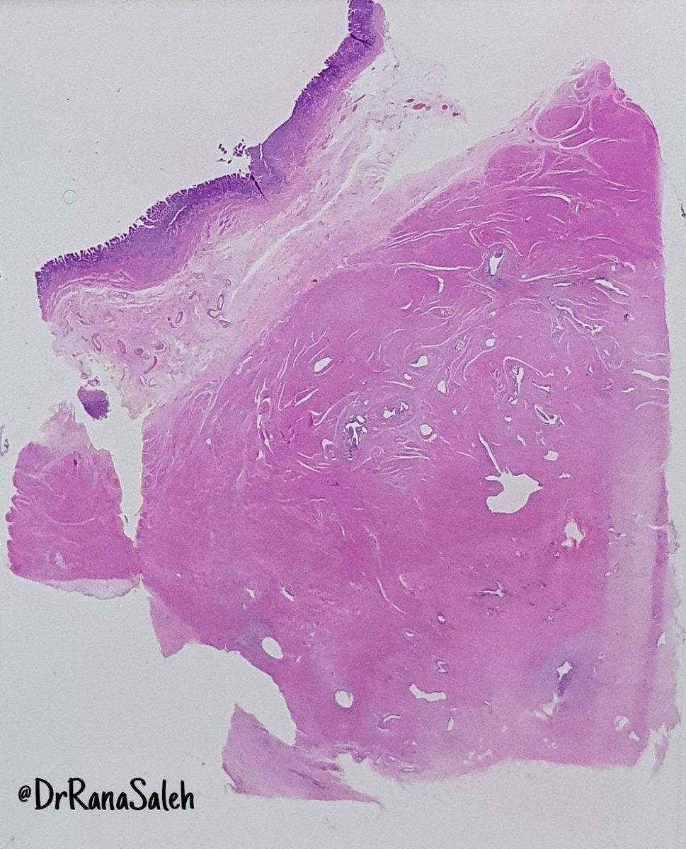 Rana Saleh, MD, FRCpath tweet media