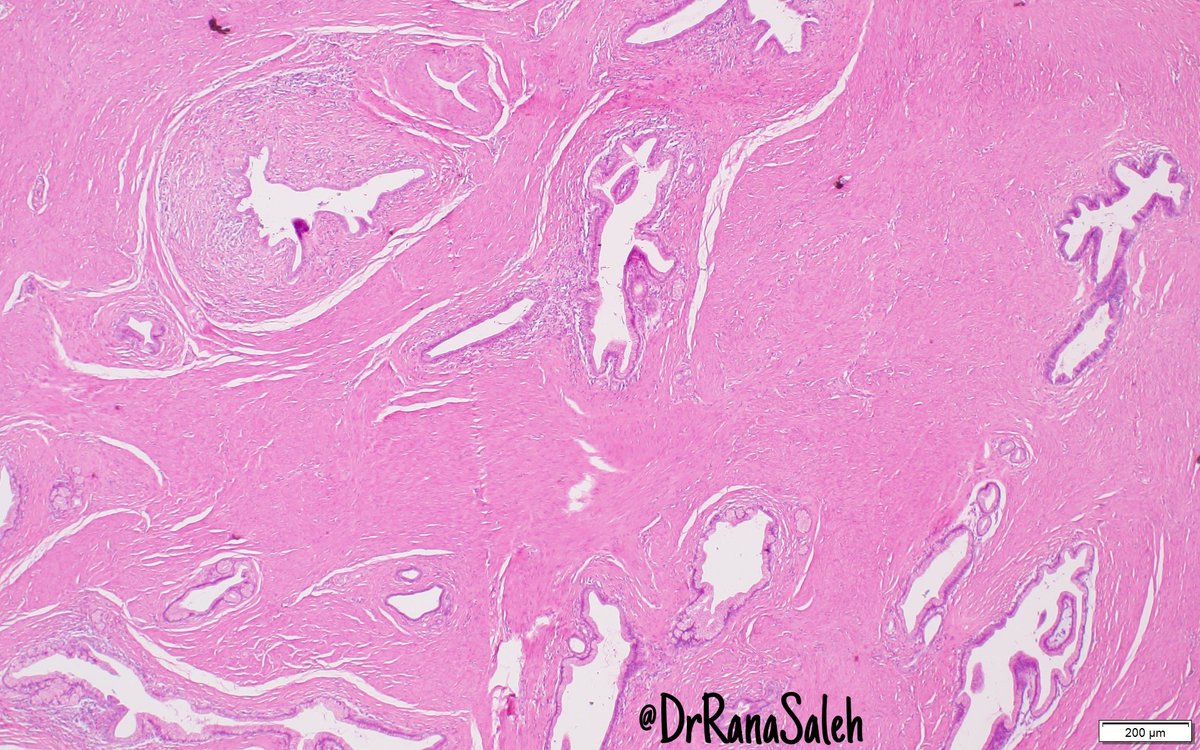 Rana Saleh, MD, FRCpath tweet media