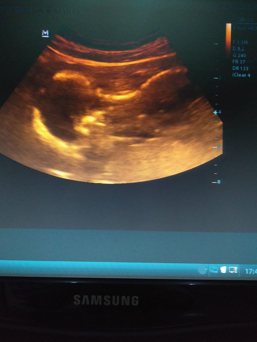 WildaSinurat1's tweet photo. Hehehe..ada yg malu ketemu dokter niee.. tengkurap gitu dianya gamau nunjukin muka nya dia ahahaha sehat2 kita ya Tondi ku😇😘 https://t.co/h41IdMfpdC