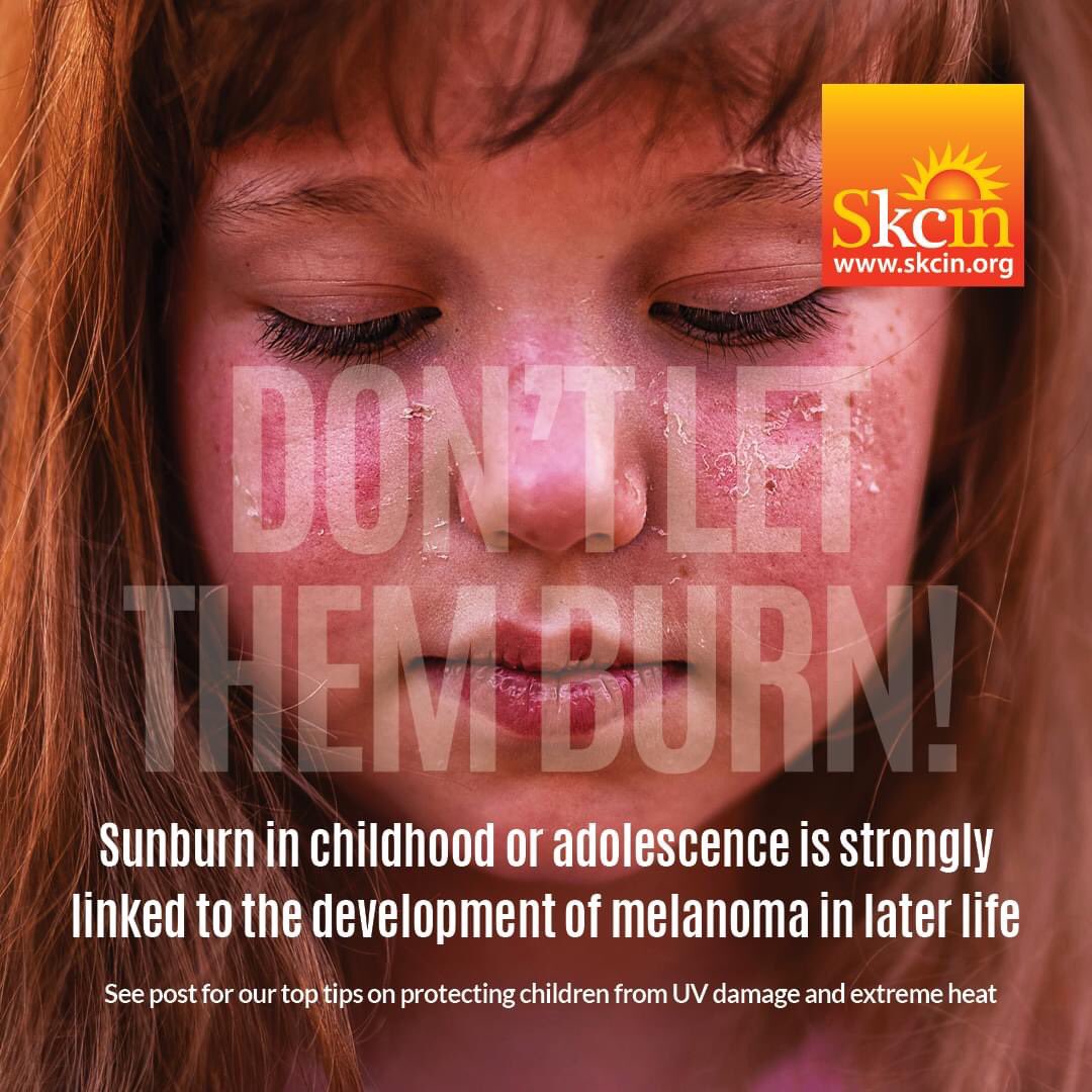 SkcinCharity's tweet image. It’s set to reach 40ºC tomorrow &amp;amp; next week,ensure children are protected against UV radiation &amp;amp; extreme heat.A child’s delicate skin is HIGHLY susceptible to sun damage &amp;amp; can burn within MINUTES.Sunburn in childhood is STRONGLY linked to the development of melanoma in later life