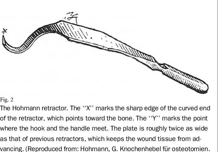 SurgeryLegends's tweet photo. German orthopaedic surgeon Georg Hohmann (1880-1970) described his eponymous retractor in an article in 1906. During WW2, he advocated for the treatment of Jewish patients despite a prohibition, and resisted Nazi sterilization policies of the physically disabled. https://t.co/HF9m9jHqNX