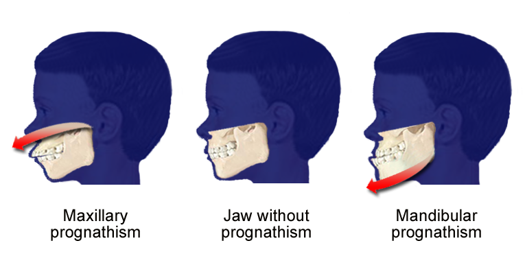 WorderFun's tweet photo. 🏵️ Word of the day: Prognathic

Having a projecting lower jaw

#worder #wordoftheday https://t.co/4OW2hooXMm