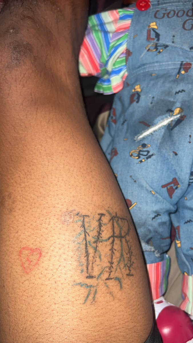 overkillty_'s tweet image. Leg look burnt asf R.I.P X
