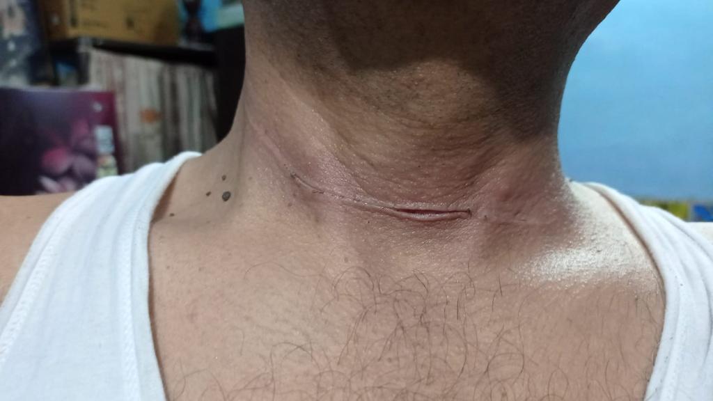 AlkaSinghpspl's tweet image. आदरणीय मुख्यमंत्री जी आपसे मेरा करबद्ध निवेदन है कृपया पतंगबाजी पर पूरी तरह बैन लगनी चाहिए।इसकी वजह से हज़ारों घटनाएं होती रहती है।ये घटना एसबाग फ्लाईओवर पर कल की है मेरे भाई की जान बच गयी समझबूझ से या ईश्वरीय कृपा से ।पर तमाम घटनाओं को रोकने के लिए सख़्ती से बैन लगना जरूरी है।