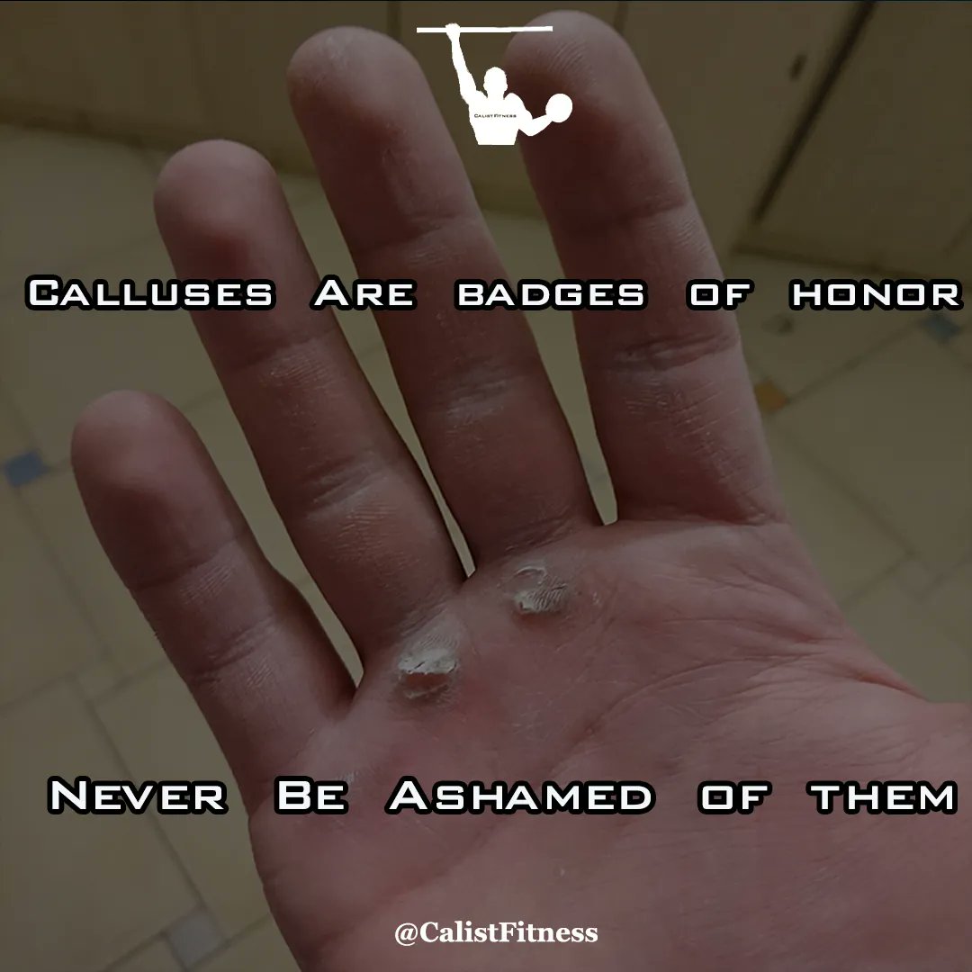 #calluses #PULLUPS #personaltrainer
#osobnitrener
#fitnesstrainer
#fitnesscoach
#calicoach
#hybridcoach
#hybridtrainings
#calistfitness 
#fitnesstips
#calisthenicstips
#calisthenicsworkout
#workoutboy
#fitnessboy
#workoutboys
#fitnessboys
#workouts  #photooftheday  #healthy