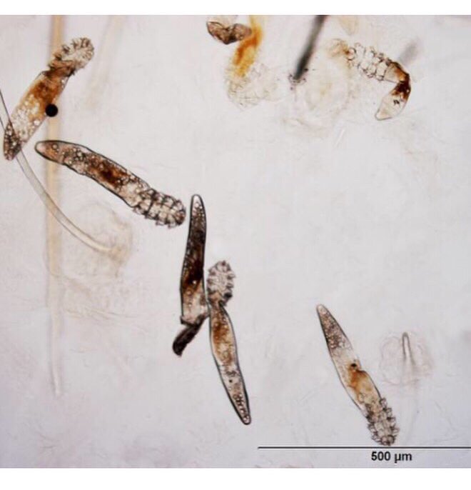 acarological's tweet photo. Prevalence and density of Demodex mites (Acari: Demodecidae) in patients with seborrheic dermatitis https://t.co/IaNaAmfGDW #acari #mite #demodex https://t.co/nXcUDXjnUO