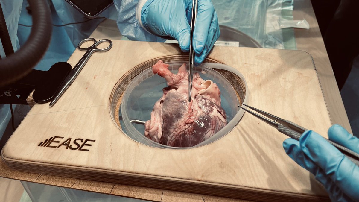 Wir hatten gestern einen erfolgreichen ersten Tag unserer Arbeitssitzung in Münster, mit wichtigen Diskussionen über die zukünftige herzchirurgische Weiterbildung und einem Skills Lab!🫀
Herzlichen Dank an Prof. Martens für Ihren Besuch und die spannende Diskussion <a href="/UK_Muenster/">Uniklinik Münster</a>