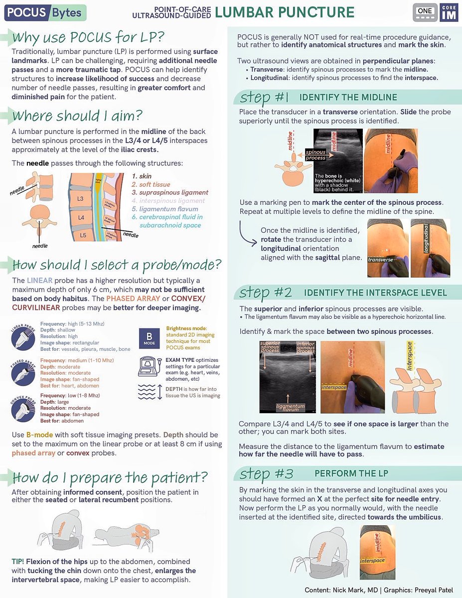 BrownJHM's tweet photo. Point-of-care ultrasound guided lumbar puncture @COREIMpodcast @OnePagerICU #BJHM #POCUS #FocusPOCUS #MedTwitter #FOAMed #Medstudenttwitter https://t.co/XpalPNqB9m