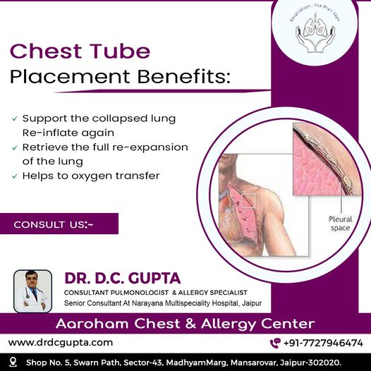 dcguptaclinic's tweet photo. Chest Tube Placement Benefits:
- Support the collapsed lung and re-inflate again
- Retrieve the full re-expansion of the lung
Want to know more benefits of chest tube placement. Meet with senior pulmonologist Jaipur.
Dr DC GUPTA
Chest and Allergy Specialist https://t.co/8JHDFmD4MK