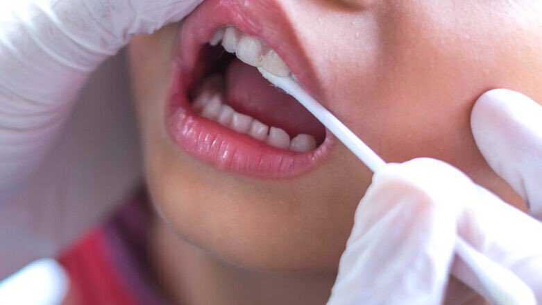 astddorg's tweet photo. Fluoride varnish is proven to reduce a child’s risk of tooth decay. Many school-based dental programs apply it to children’s teeth. Learn more: https://t.co/YwNW1Us22y https://t.co/CQ6pEZJz8j