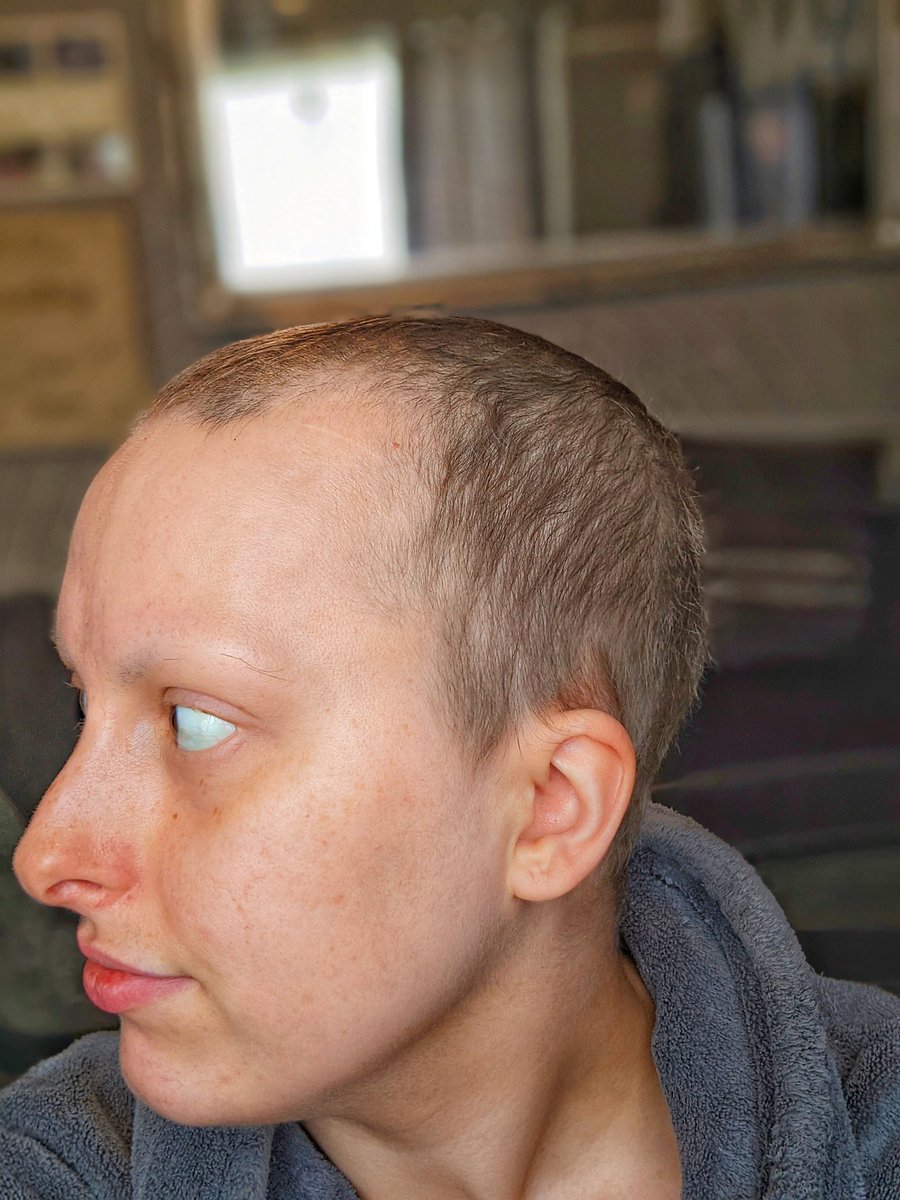 angelinahardy16's tweet photo. Hello hair regrowth 🥰🎉
#aftercancer #chemotherapy #chemohairloss #hairgrowth #FridayFeeling #FeelingMyself #feelingblessed #hair https://t.co/pcRlx9gSlM