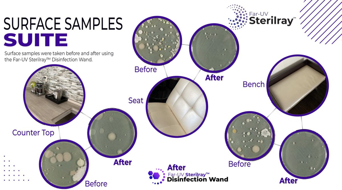 FarUVSterilray's tweet image. Travel SOP:
   1.  Always masked
   2. Check in at hotel
   3. Disinfect the rooms high touch surfaces with the GermBuster Sabre
   4. Disinfect the air in the room (equate up to &amp;gt;182 ACH: go.nature.com/3sDFqJP)
   5. Sleep well
Info@sterilray com
#apic2022 #222nm #FarUV