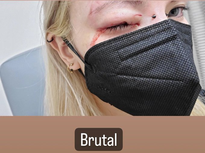 Out of commission for a while 😔 https://t.co/kDh6QJ6bhr