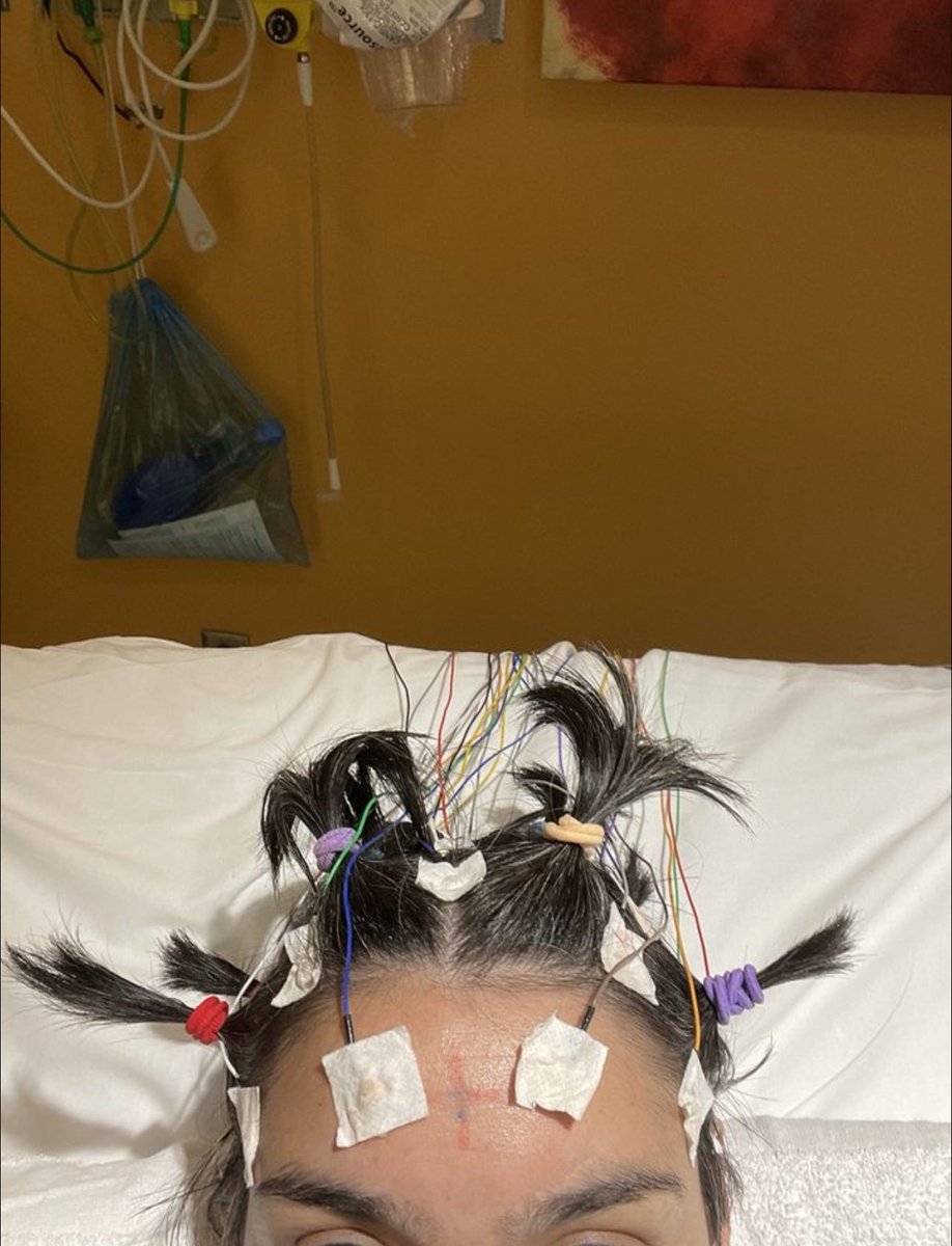 uabneurores's tweet photo. Nice PDR...and hair 😜 Our residents on peds are maybe all play and no work? Thanks for helping the techs over at CoA learn how to place EEGs!
#uab #neuroresidents #neurology #pedsneuro #childrensofalabama #uasom #neuro #epilepsy #eeg https://t.co/pokgvl042b