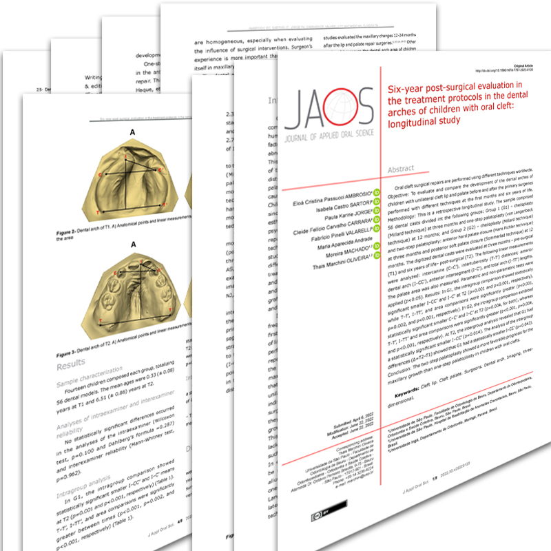 JournalJAOS's tweet photo. Six-year post-surgical evaluation in the treatment protocols in the dental arches of children with oral cleft: longitudinal study

https://t.co/BsybtSkF6v

#cleftlip #cleftpalate #surgeons #dentalarch #threedimensionalimaging #jaos

@RedeSciELO @abcdusp https://t.co/HrLowAnAlC