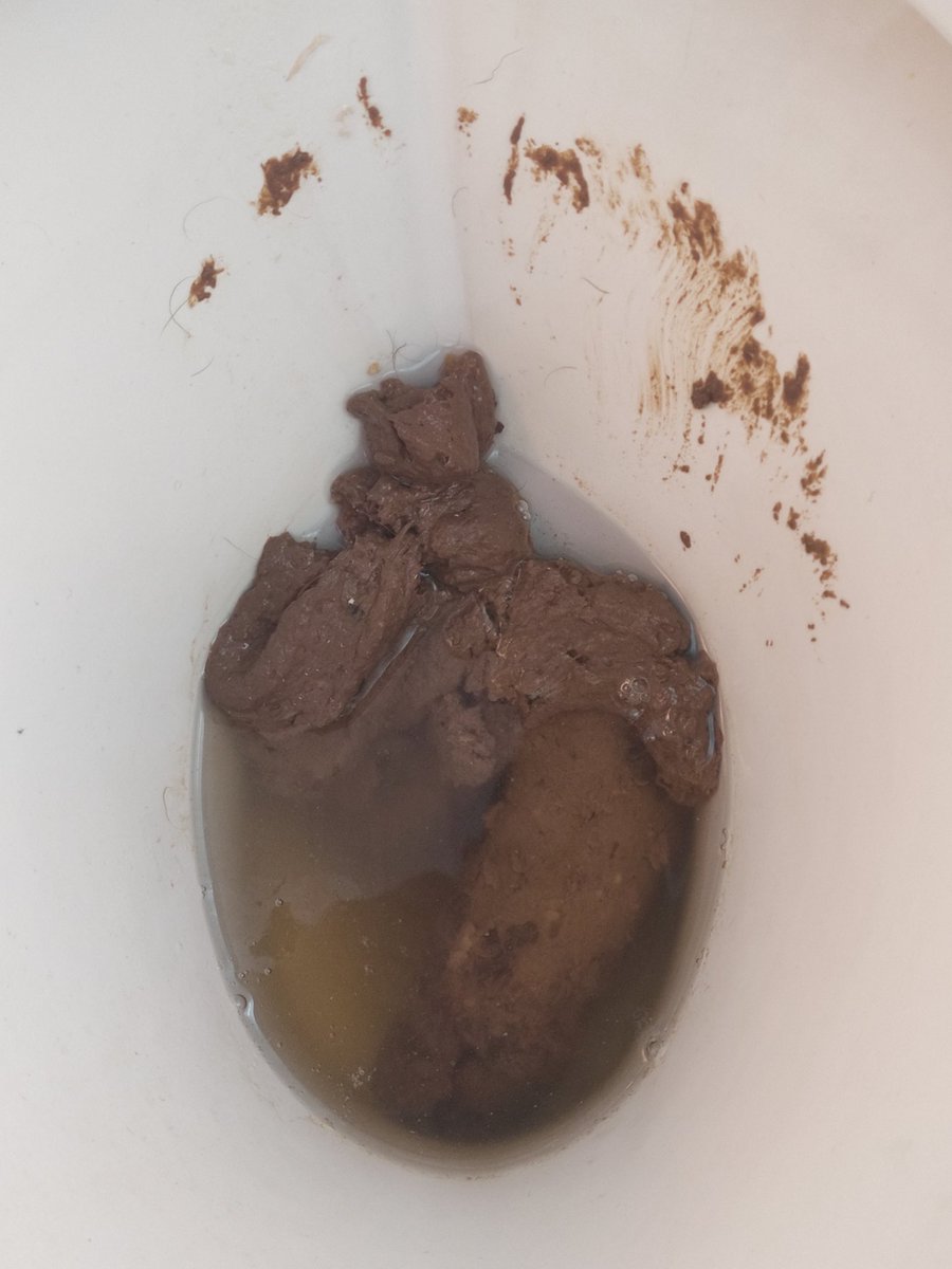 brazil_scat's tweet photo. A brown human heart ๐ค๐ฉ
#scat #eproctophilia #Poopgirls #scatslave #scateater #scatclips #scatvideos #pooplover #poopvideos #poop #scatslut #Toiletslut #toiletpoop #publicbathroom #shitpig #scatpig #shitvids #slave https://t.co/e1vQOMU6qy