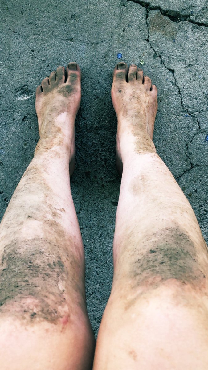 EarthGoddessBri's tweet photo. Any #dirtyfeetlovers https://t.co/P0q1G12yjA