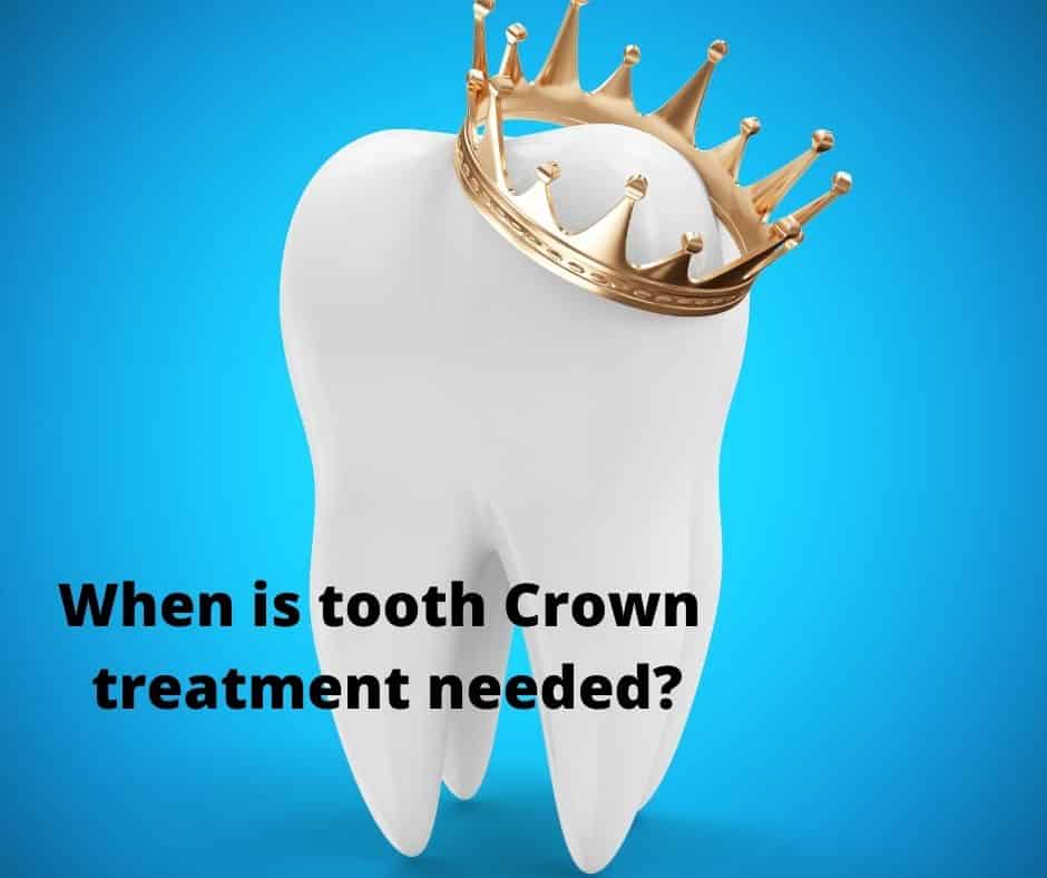 DentistryTfi's tweet photo. If one or more of your #teeth are affected by decay, 
chips, cracks, discolouration or other forms of damage,
DENTAL CROWNS may provide an #idealsolution.
Crowns offer both #cosmetic &amp; #oralhealth benefits, 
reinforcing the structure of the #tooth. 
https://t.co/6i8AYAh5YS https://t.co/T07zgrl7PG