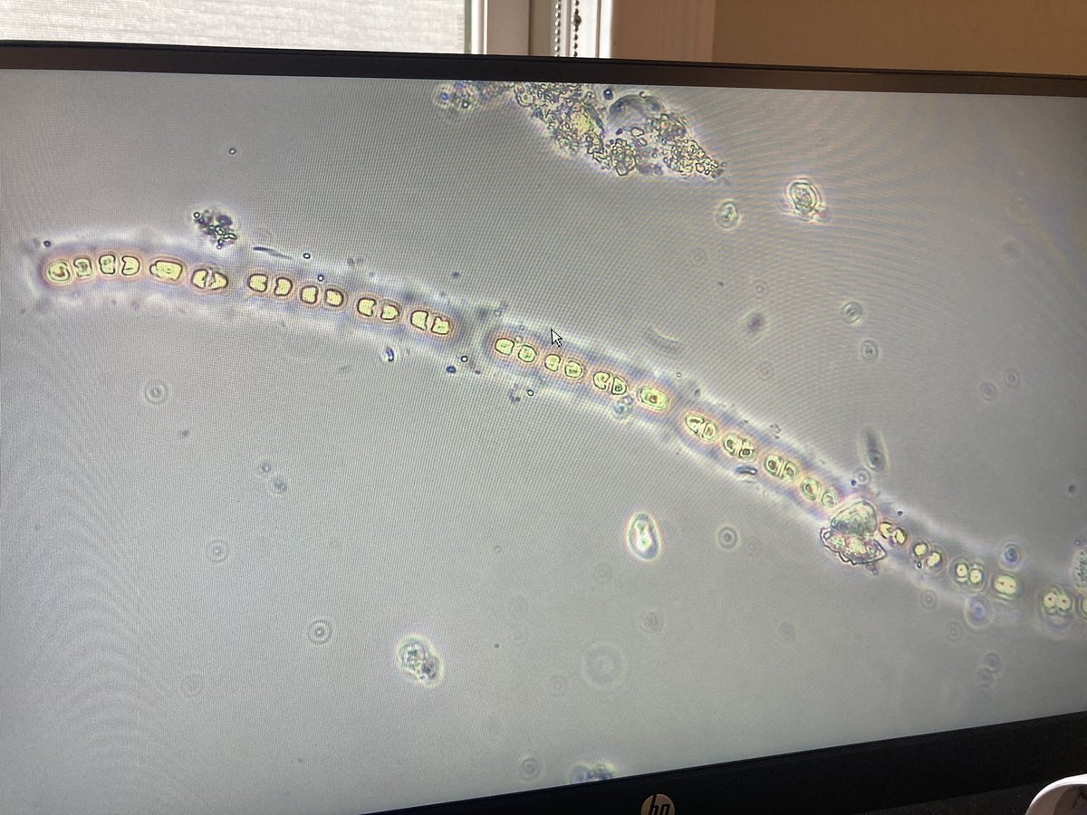 aquatic_abby's tweet photo. It's #PhycologyFriday and I'm not sure where to start with this ID. Chain of tiny greens? Could it be a desmid? Cyano? (But I think I see chloroplasts and starch granules) 
Found in periphyton assemblage from a mesotrophic lake. More details below 🔬 https://t.co/YnNnwuRjuW