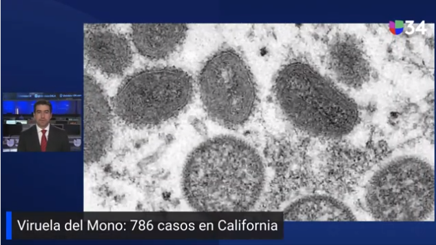 593ProSeg's tweet photo. VIRUELA DEL MONO: CALIFORNIA reporta 786 CASOS de la VIRUELA del MONO y el 35.8% de los CONTAGIOS son LATINOS. Aquí la historia 👉 https://t.co/UiiZrUDxmb
.
.
#Covid19 - #coronavirus - #proseg &amp; #Saludsa - #seguromedico - #seguros - #HepatitisInfantil  - #ViruelaDelMono https://t.co/Ssmm4H2dvm