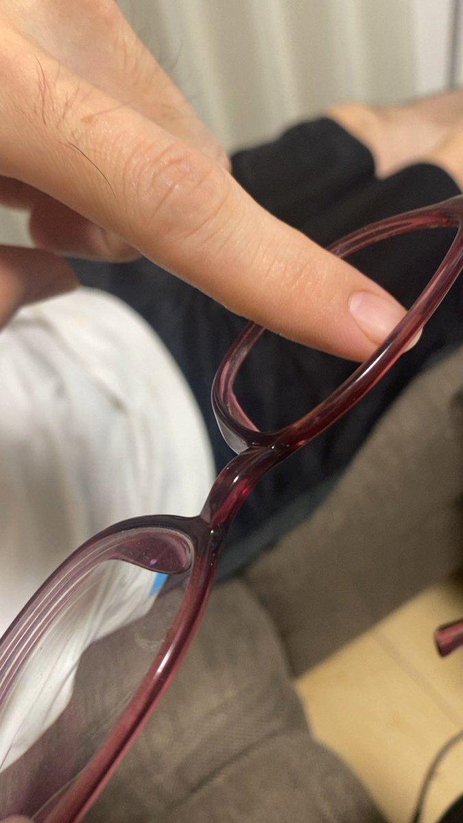 起きたら片目だけ視力が落ちてる 4時間後に判明した理由に笑ってしまう 転んだあとこれだった Togetter
